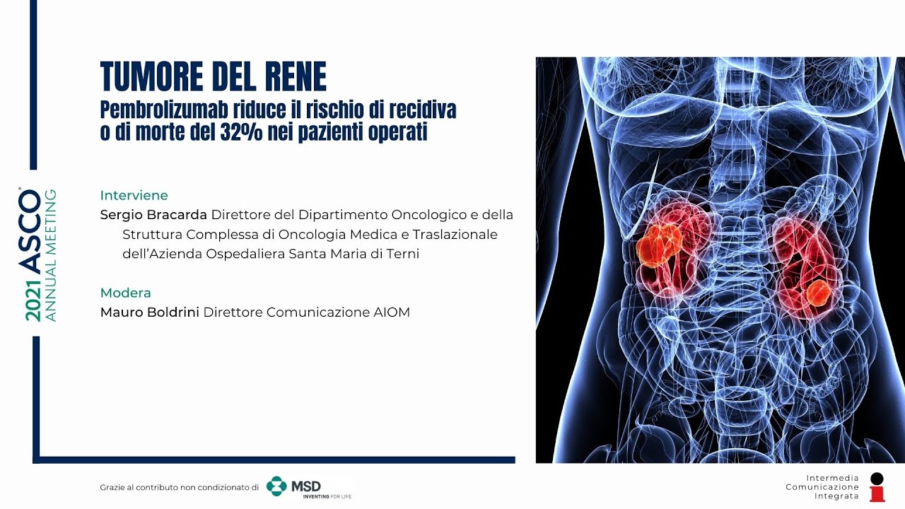 Tumore del rene: efficacia dell’immunoterapia dopo la chirurgia