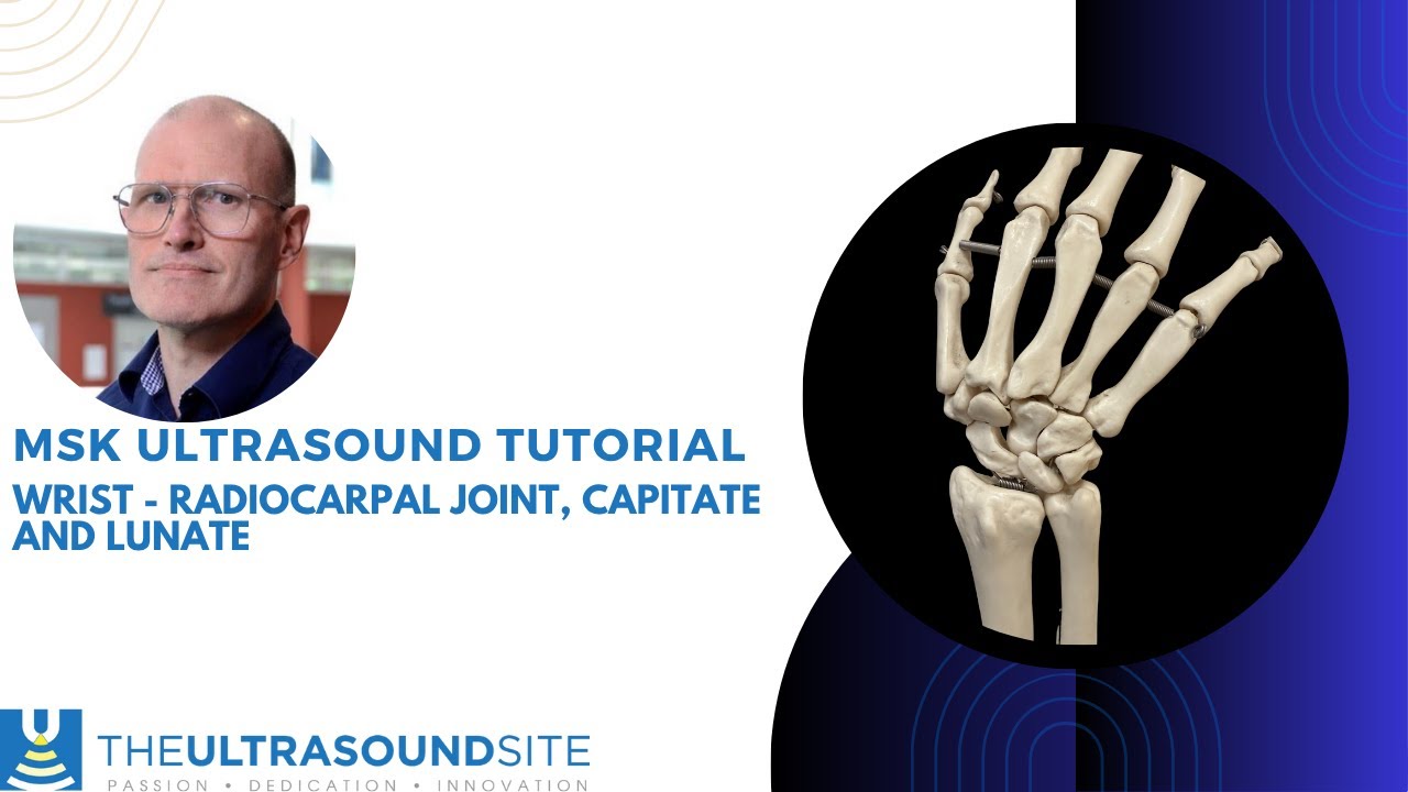 Find the wrist joint on ultrasound!