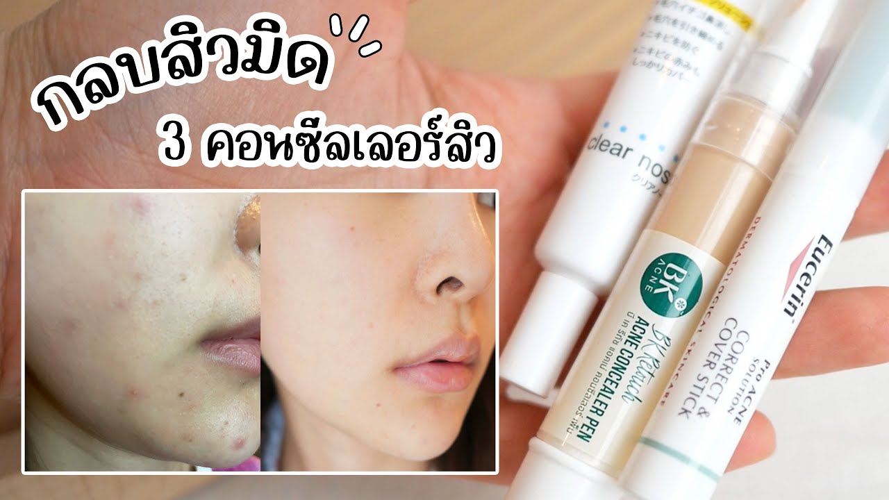 ปิดสิว รอยสิวเนียนกริบ ใช้คอนซีลเลอร์สิวตัวไหนดีสุด !