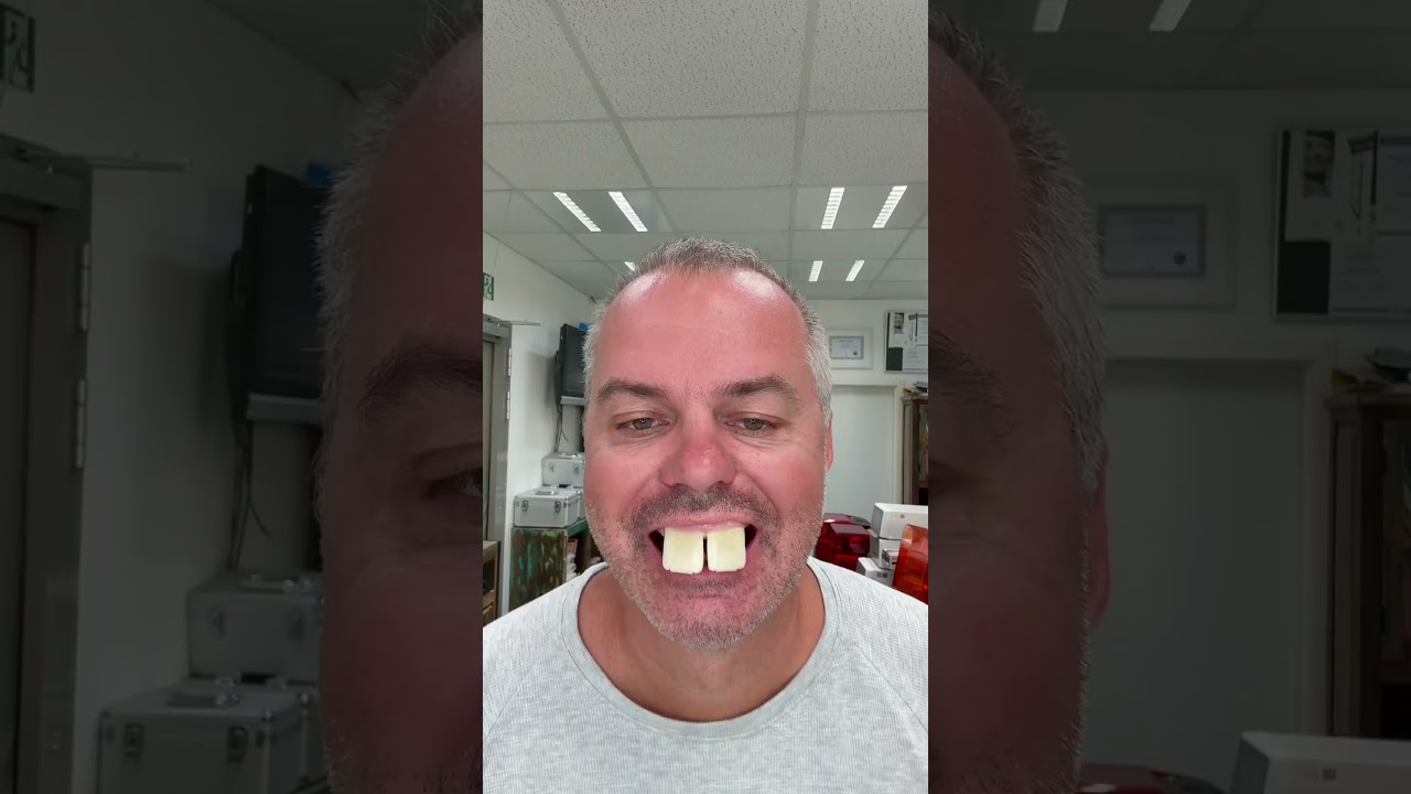 When you try to fake perfect teeth #FakeTeeth #ToothParody #FunnySmile #DentistCheck #GoofyTeeth