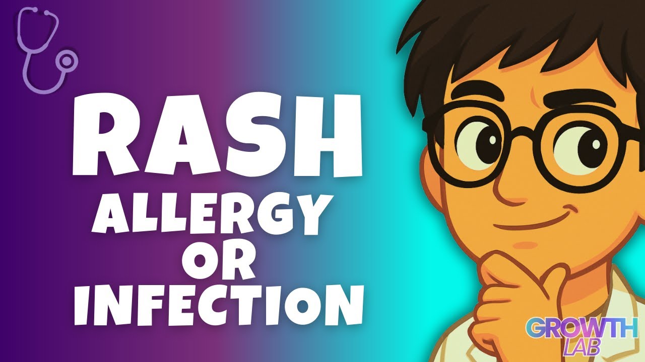 Red Itchy Skin. Allergy or Infection | Growth Lab Disease Detective Series