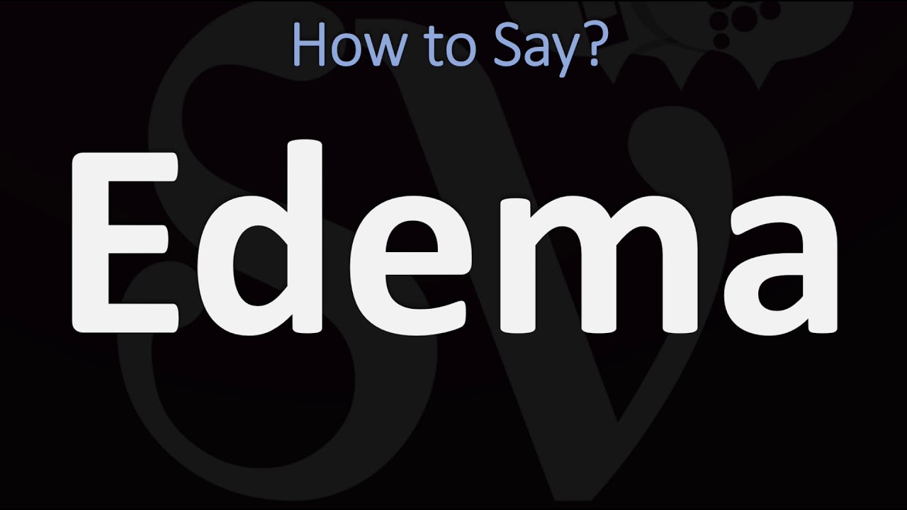 How to Pronounce Edema? (CORRECTLY)