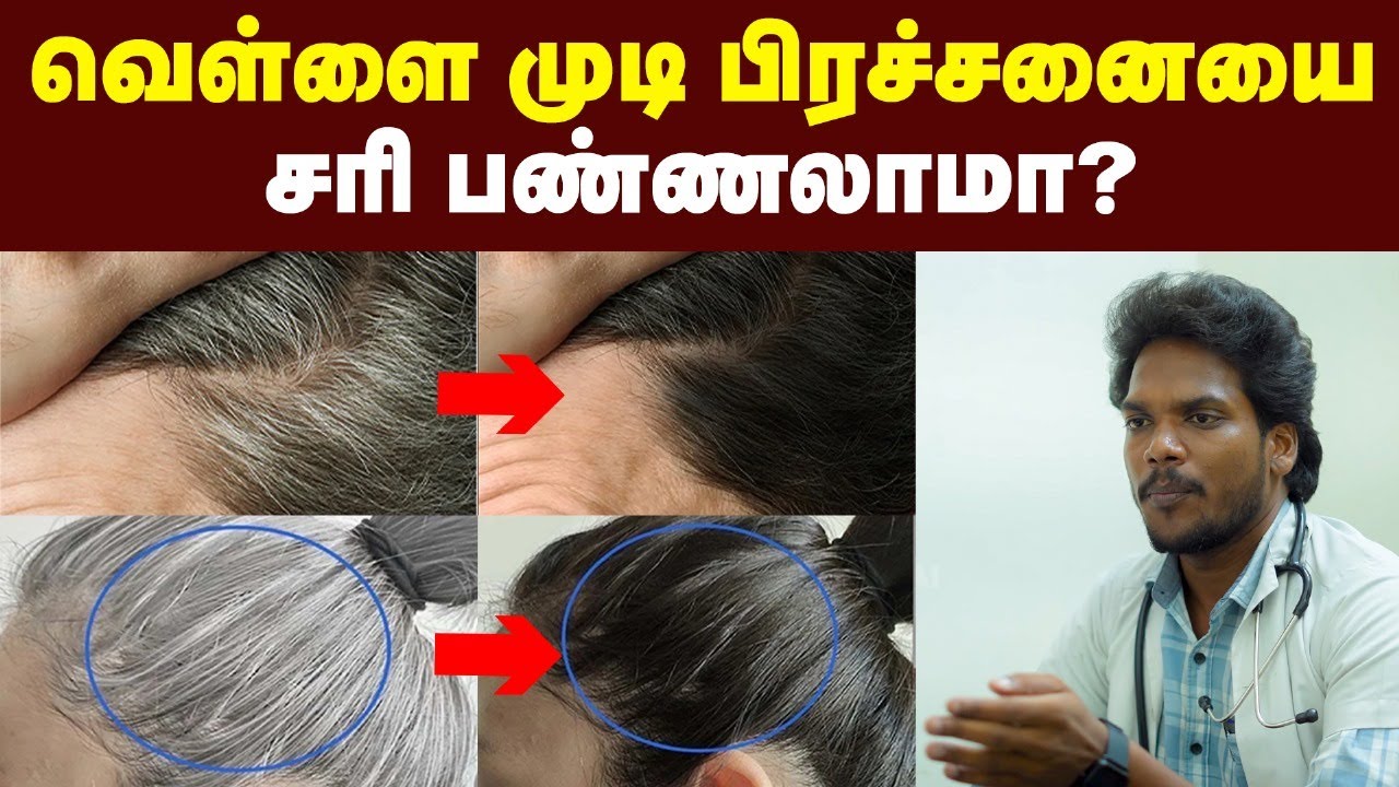 White Hair : இனி நரை முடி வந்துருச்சுன்னு Feel பண்ணாதீங்க | Solution for White Hair Problem | Hair