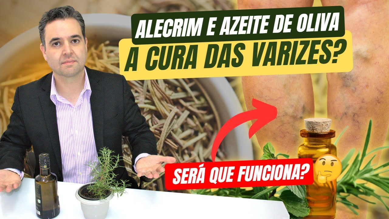 🔴 ADEUS às VARIZES com ALECRIM e AZEITE de oliva! Será que é a cura das varizes? 🤔