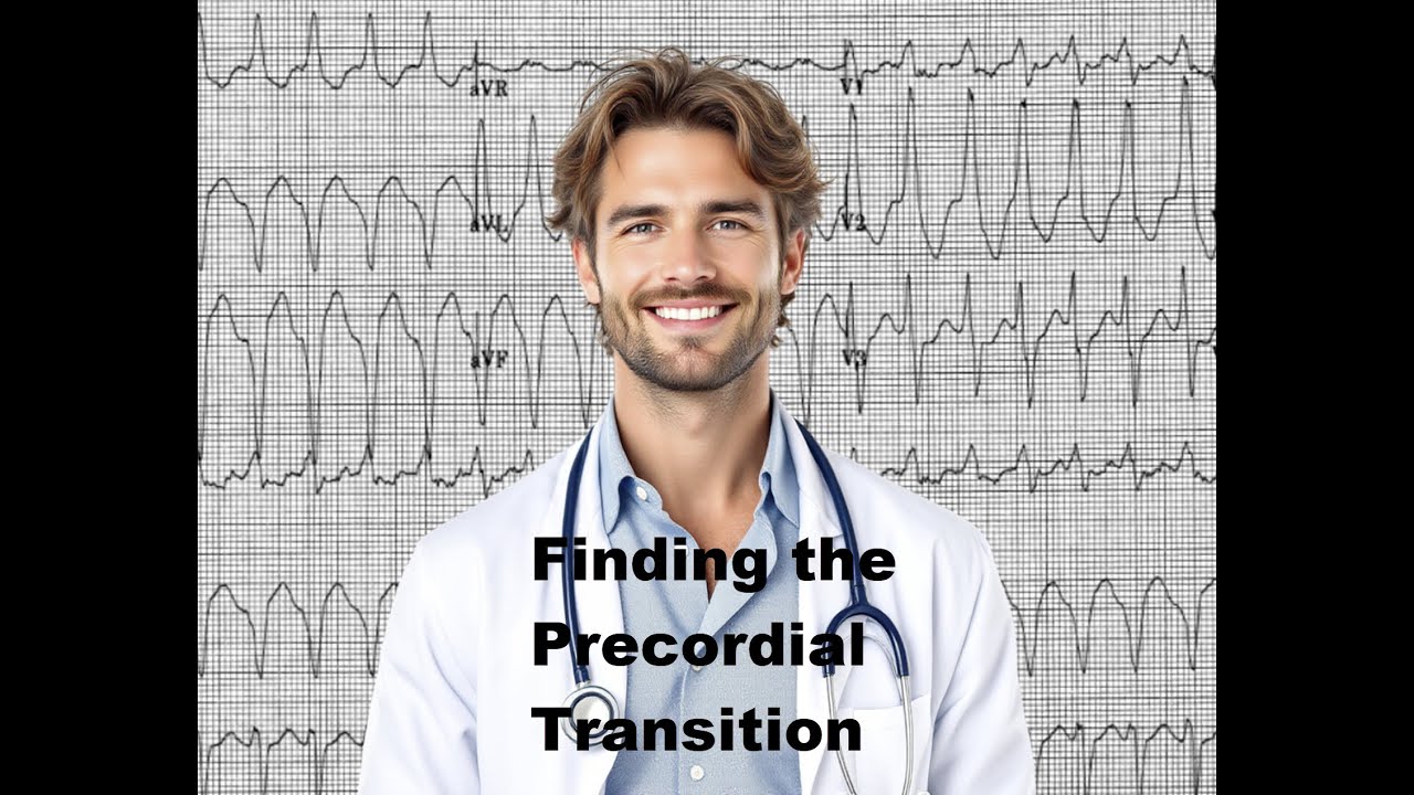 Finding the Precordial Transition