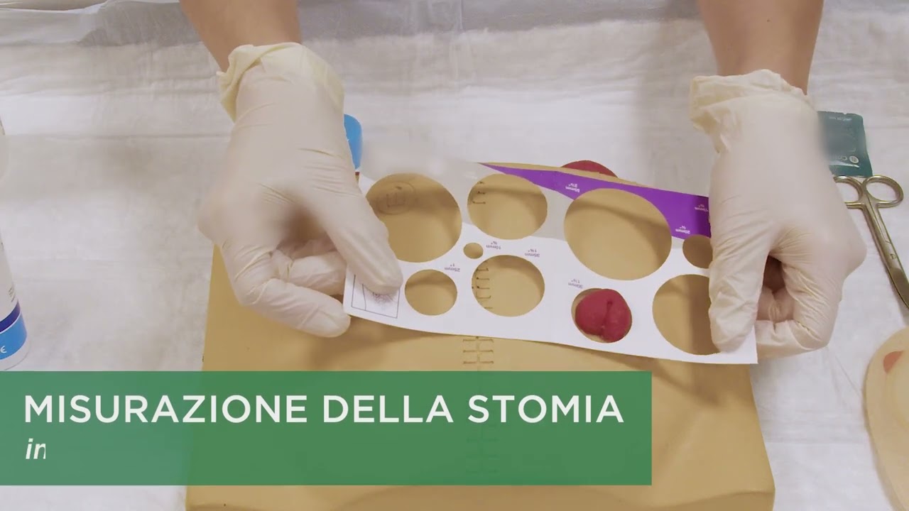 Guida allo stomacare - Colo/ileostomia sistema monopezzo