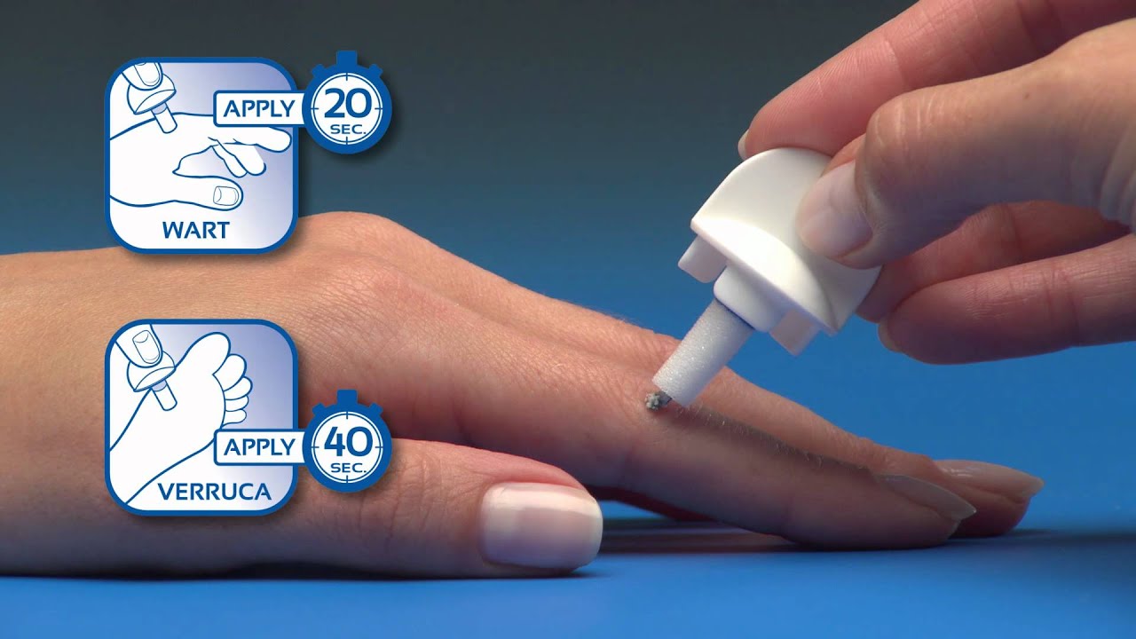 Wartner 2nd Generation - Instructional video