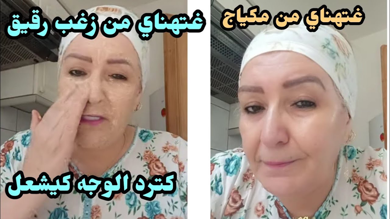 وصفة سحرية كتحيد زغب من الوجه كتحيد حبوب  والكلف والبقع  اكتر من رائعة كترد الوجه كيشعل او صافي