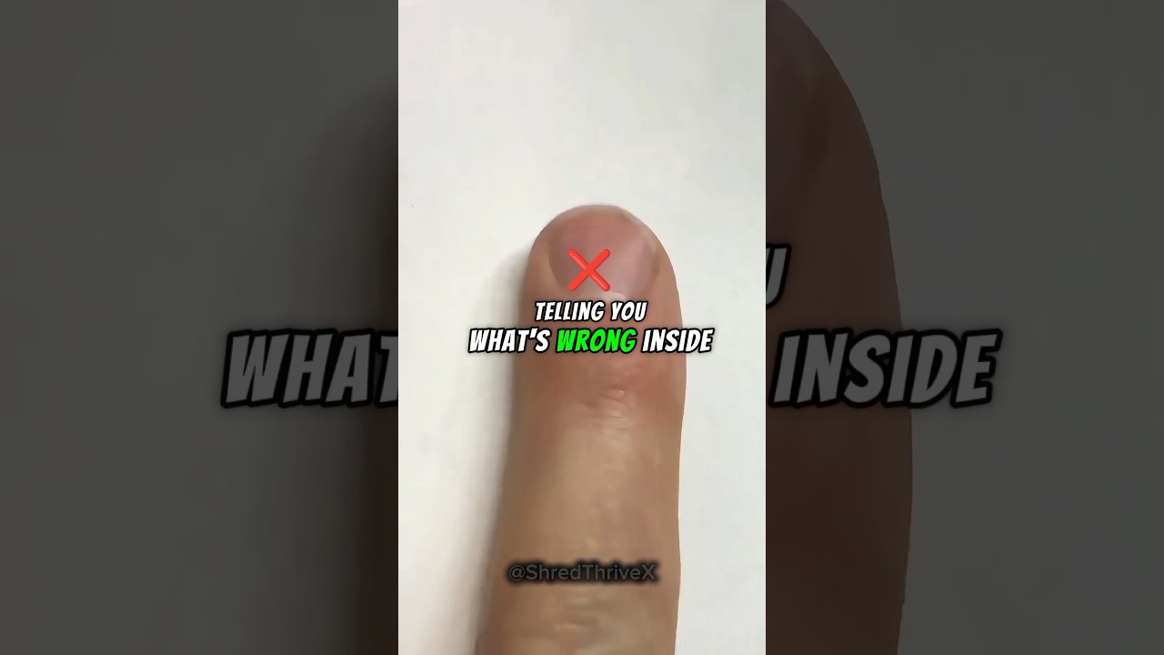 6 признаков проблем с ногтями, которые указывают на скрытые проблемы со здоровьем 