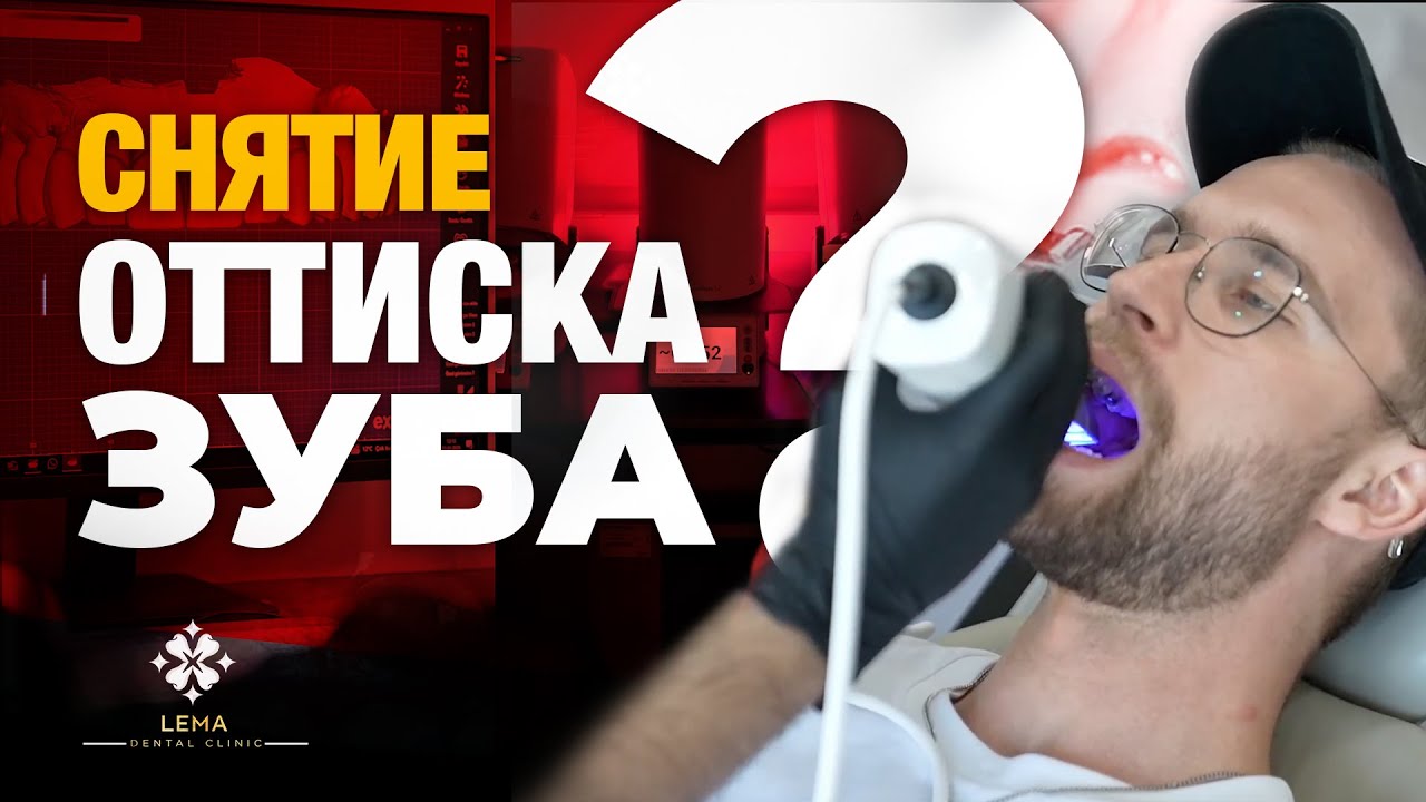 🤍 (с субтитрами) Как снять оттиск с зубов? - Стоматологическая клиника 
