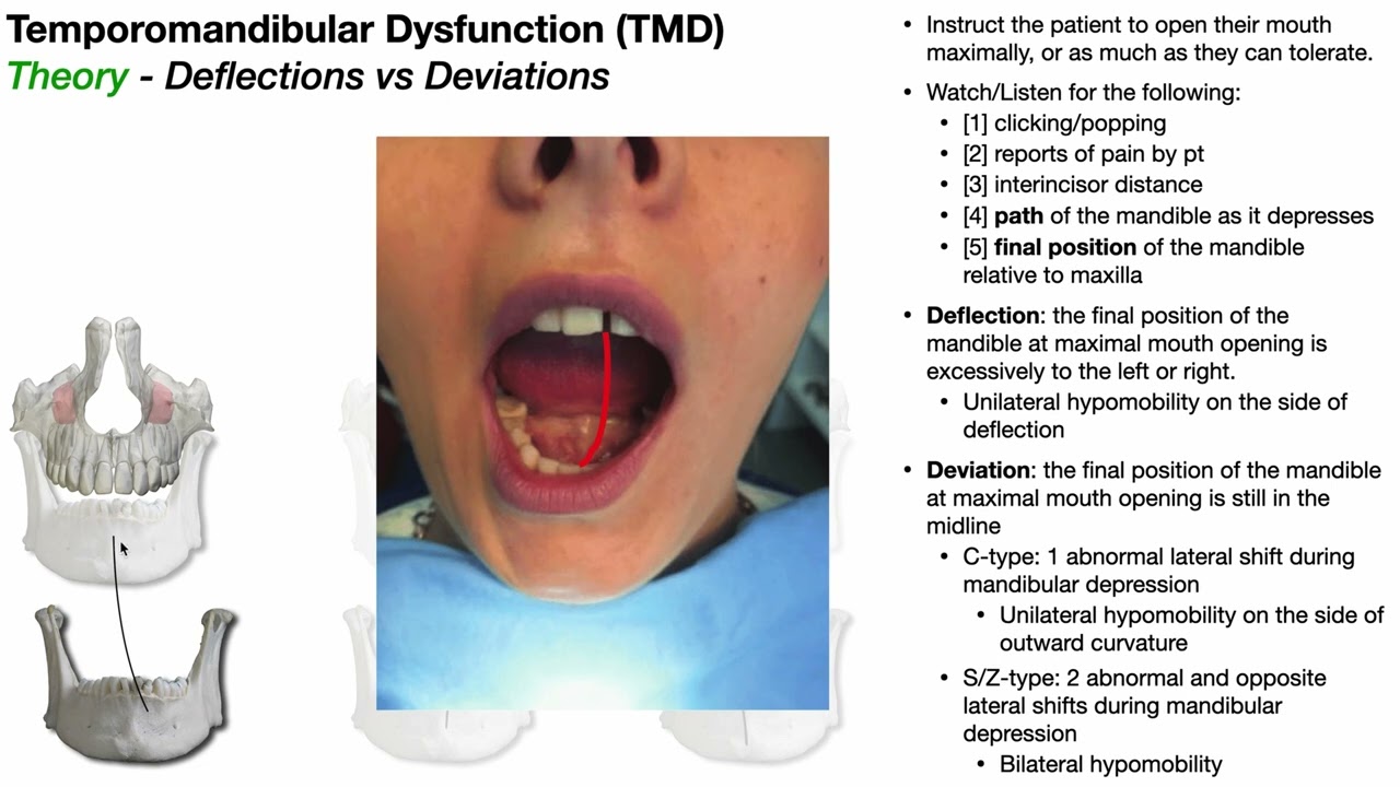 TMJ & TMD | Deflections VS Deviations