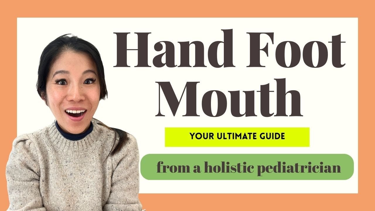 How to Prevent and Treat Hand Foot Mouth