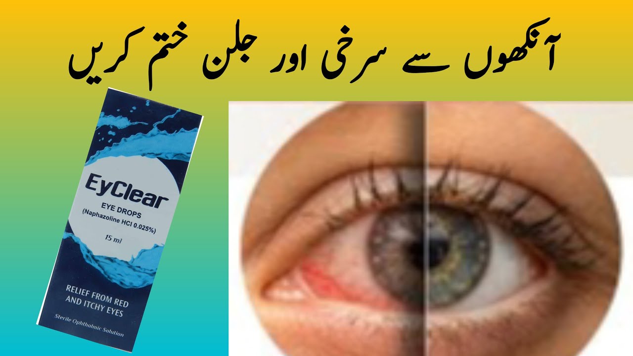 How to remove eye irritation | How to get rid of eye pain and redness | Naveedshaheen-01