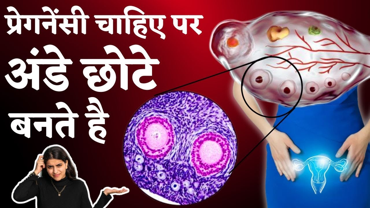 प्रेगनेंसी चाहिए पर अंडे छोटे बनते है - Egg size & quality tips, fertility tips #prernafertilitycare