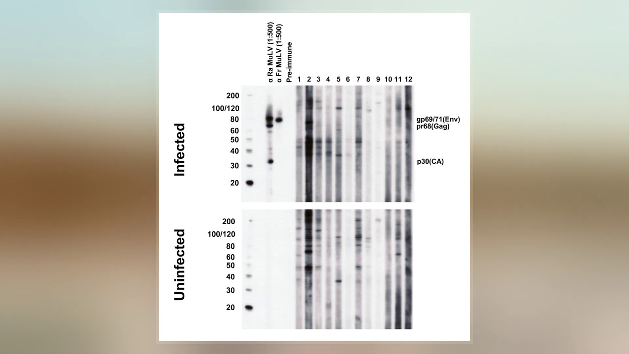 Xenotropic Murine Leukemia Virus-Related Virus