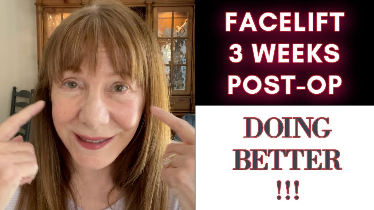 My facelift 3 Weeks post-op!
