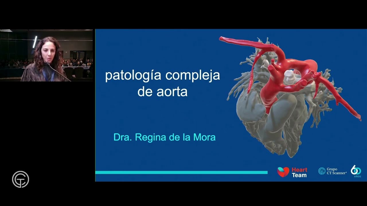 Patología compleja de la aorta