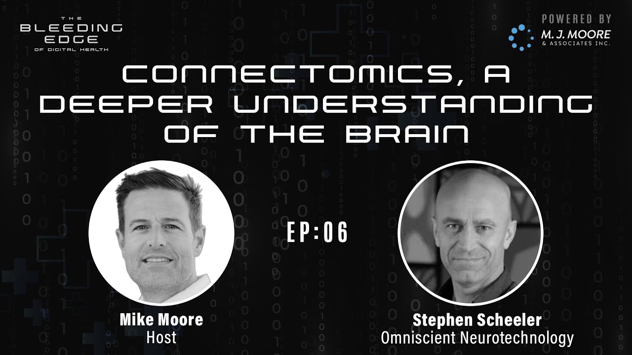 Omniscient Neurotechnology: Connectomics, a Deeper Understanding of the Brain