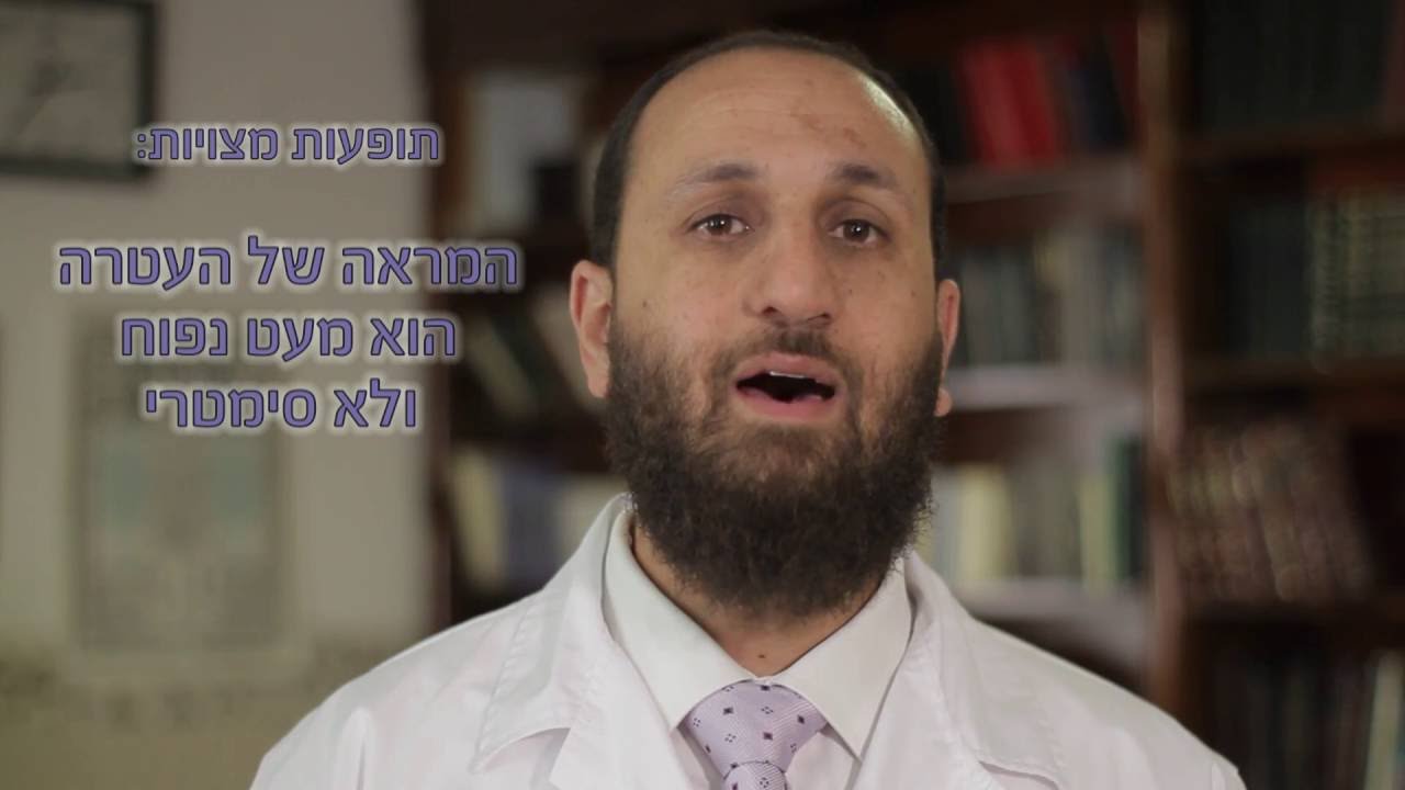 איך לטפל בתינוק אחרי ברית המילה? | הרב עקיבא | מוהל מוסמך