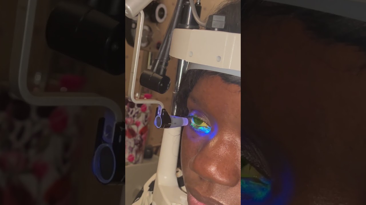 Can High Eye Pressure Cause Glaucoma?