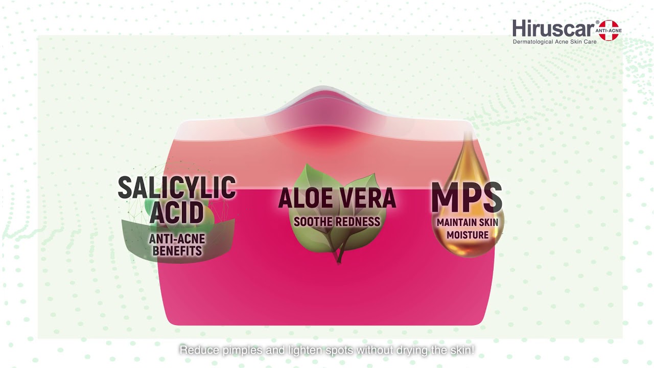 Hiruscar Anti Acne - Pimples to the rescue - Featuring NOC Franster! (15-sec version)