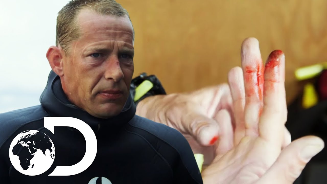 Injury Puts An Early End To Captain Kris' Dive | Gold Divers