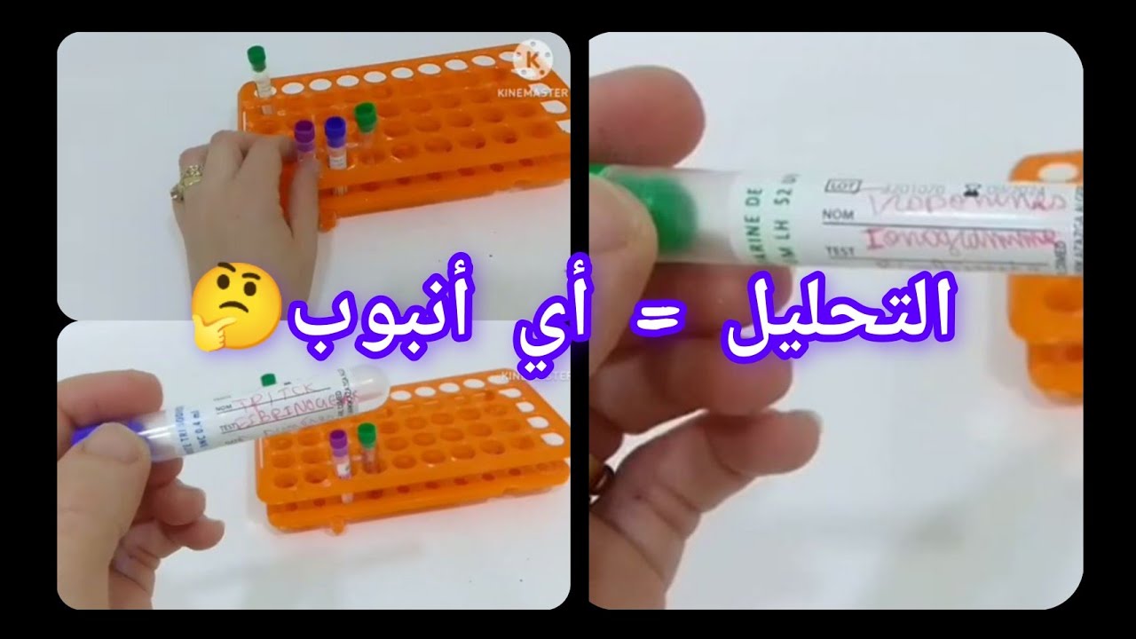 إختيار أنانبيب الدم على حساب التحليل / Les tubes des prélèvements sanguins