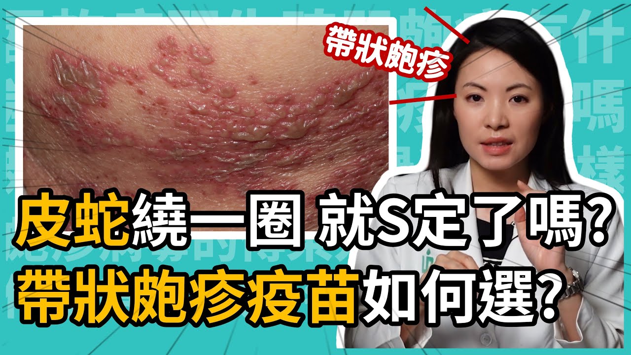 帶狀皰疹皮蛇繞一圈，就死定了嗎？民俗療法斬蛇有效嗎？帶狀皰疹疫苗該選哪一種？皮膚科林昀萱醫師帶你認識伏帶疹 (Zostavax) 和欣剋疹 (Shingrix)的差別吧！