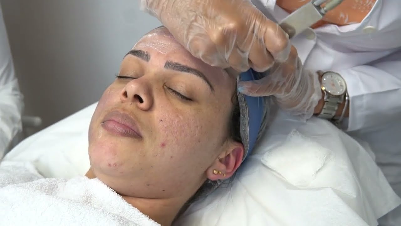 Aprenda a fazer o Peeling de Cristal