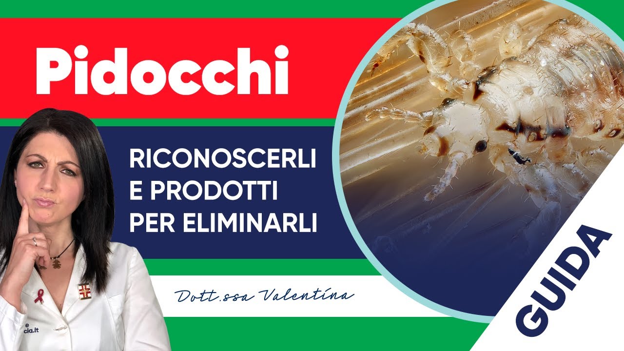Pidocchi capelli: come riconoscerli e quali sono i migliori prodotti per eliminarli