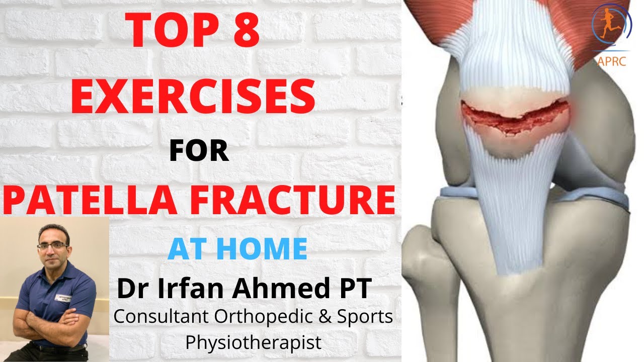 Top 8 Physiotherapy Exercises for Patella fracture Rehabilitation at Home | In Urdu Hindi