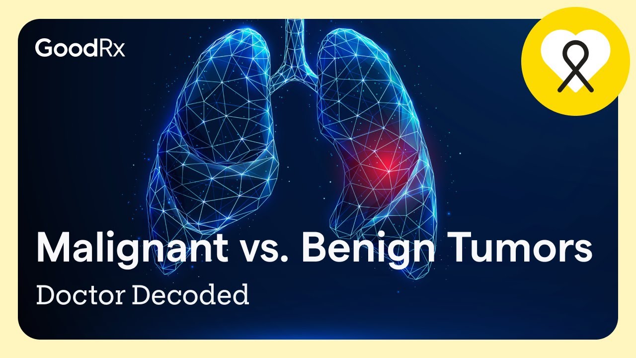 Doctor Decoded: Malignant vs. Benign Tumors | GoodRx