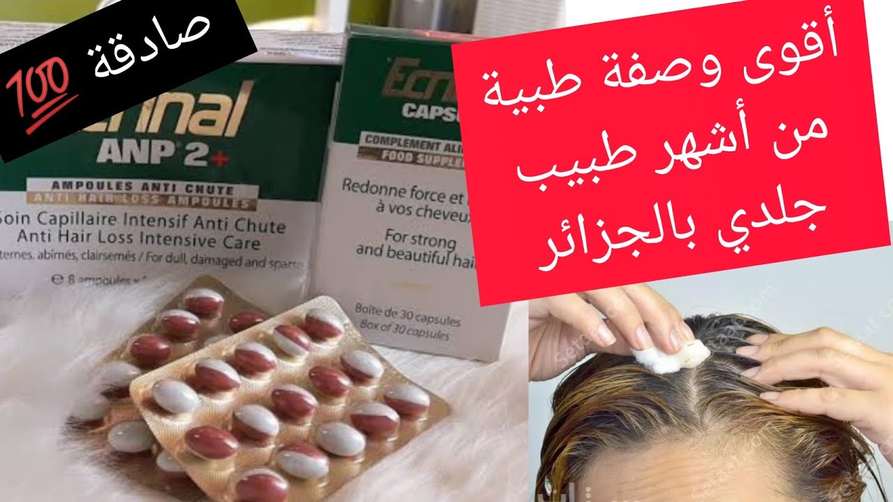 شعرة متزيديش طيح بربي وكامل لبلايص الفارغين يعاود ينبت فيهم شعر من جديد أقوووى وصفة جربتها في حياتي