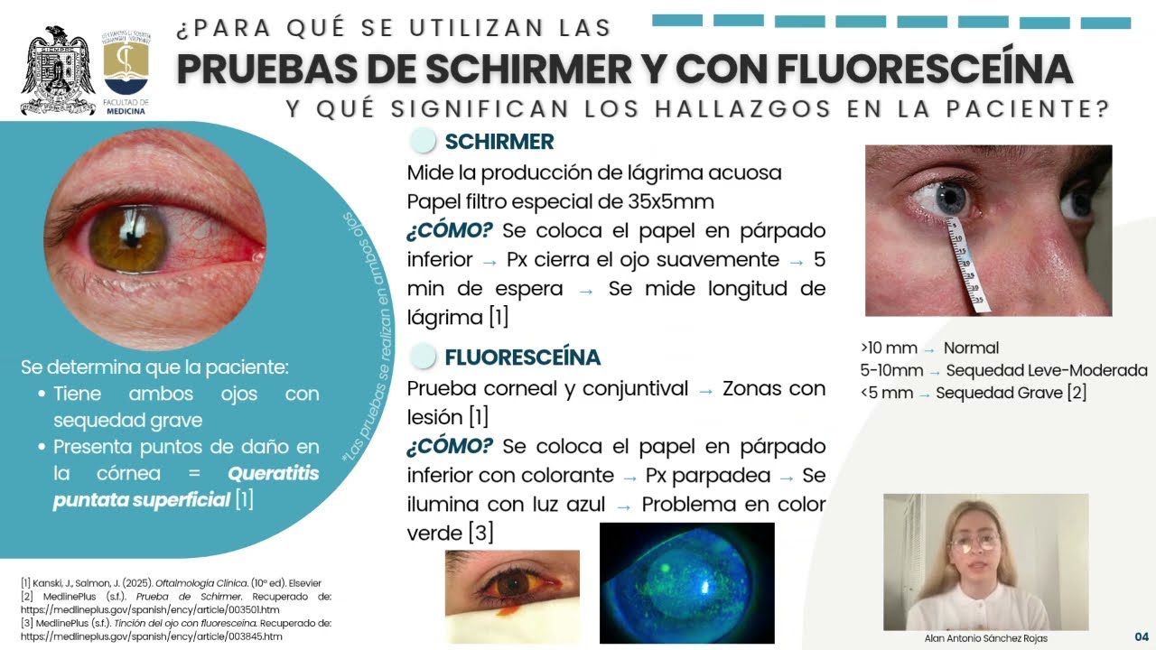 CASO CLINICO 12