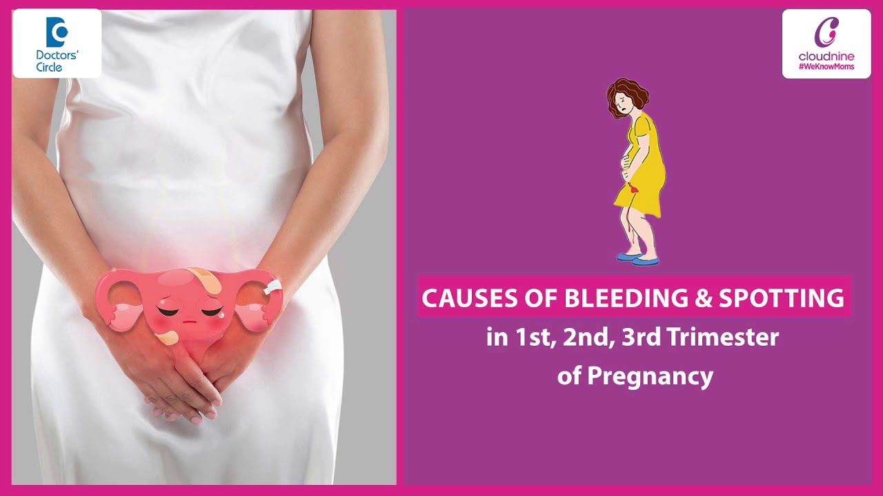 Bleeding during early pregnancy | Bleeding 1st, 2nd, 3rd trimester #pregnancytips -Dr.Ashima Gulia