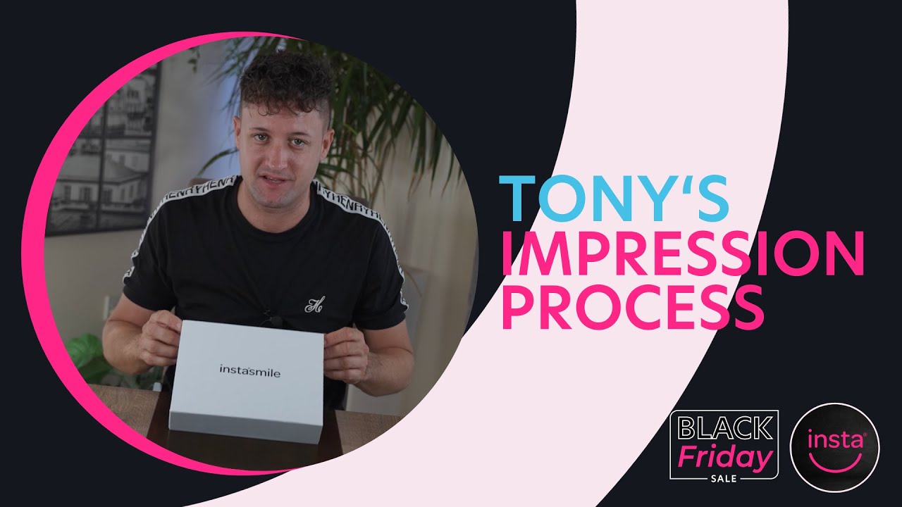 The instasmile Impression Process | Tony's First Time Pass