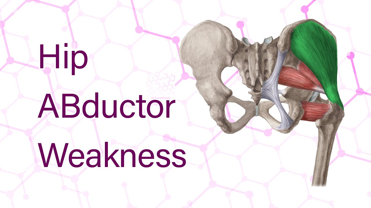 Hip Abductor weakness