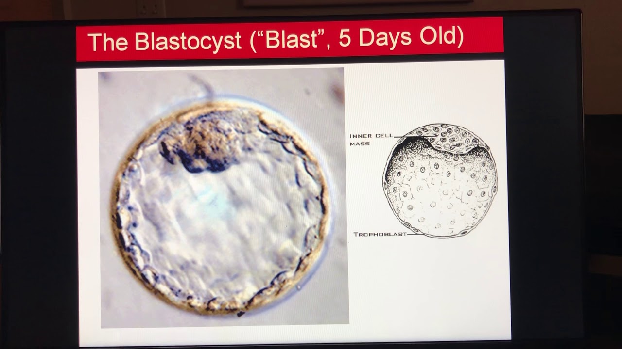 IVF:  Embryo development in the lab & PGT (Part 3)