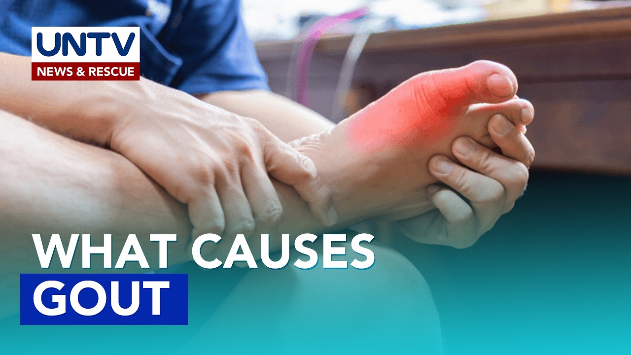Understanding Gout: Formation, Causes, and Impact