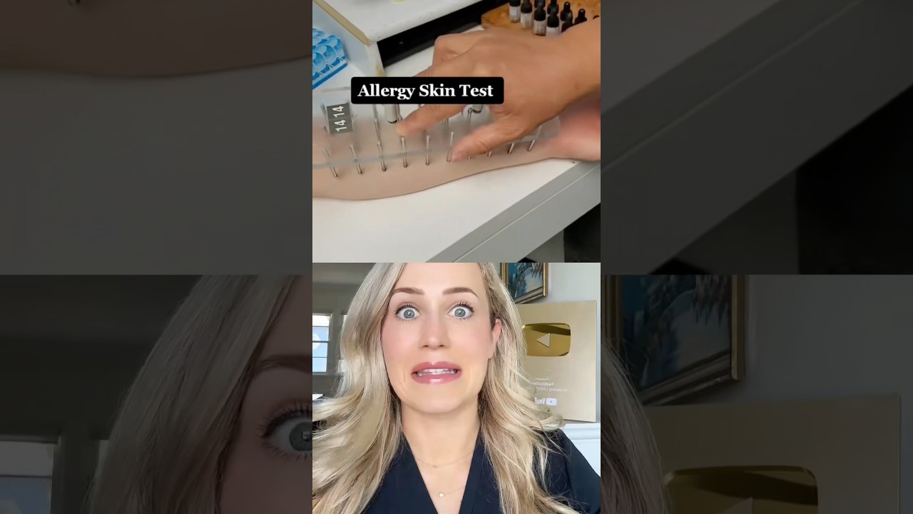TAK działają testy alergiczne