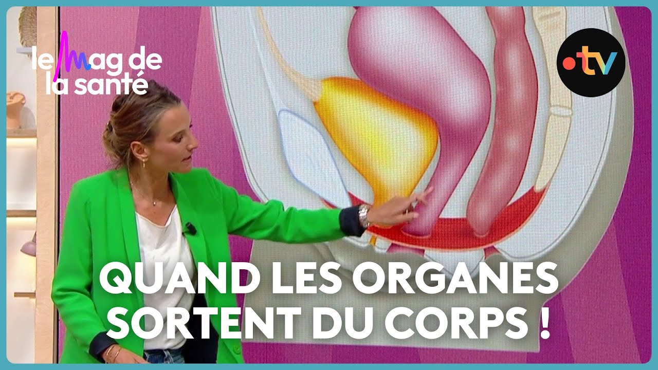 Pourquoi les femmes sont plus touchées par les prolapsus (descente d'organes) ?