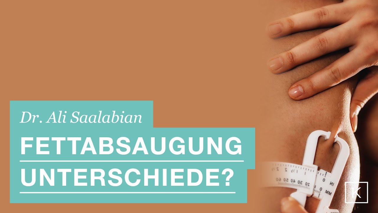 Liposuktion: Gibt es Unterschiede zwischen &auml;sthetischer Liposuktion und Liposuktion bei Lip&ouml;dem? 🤔