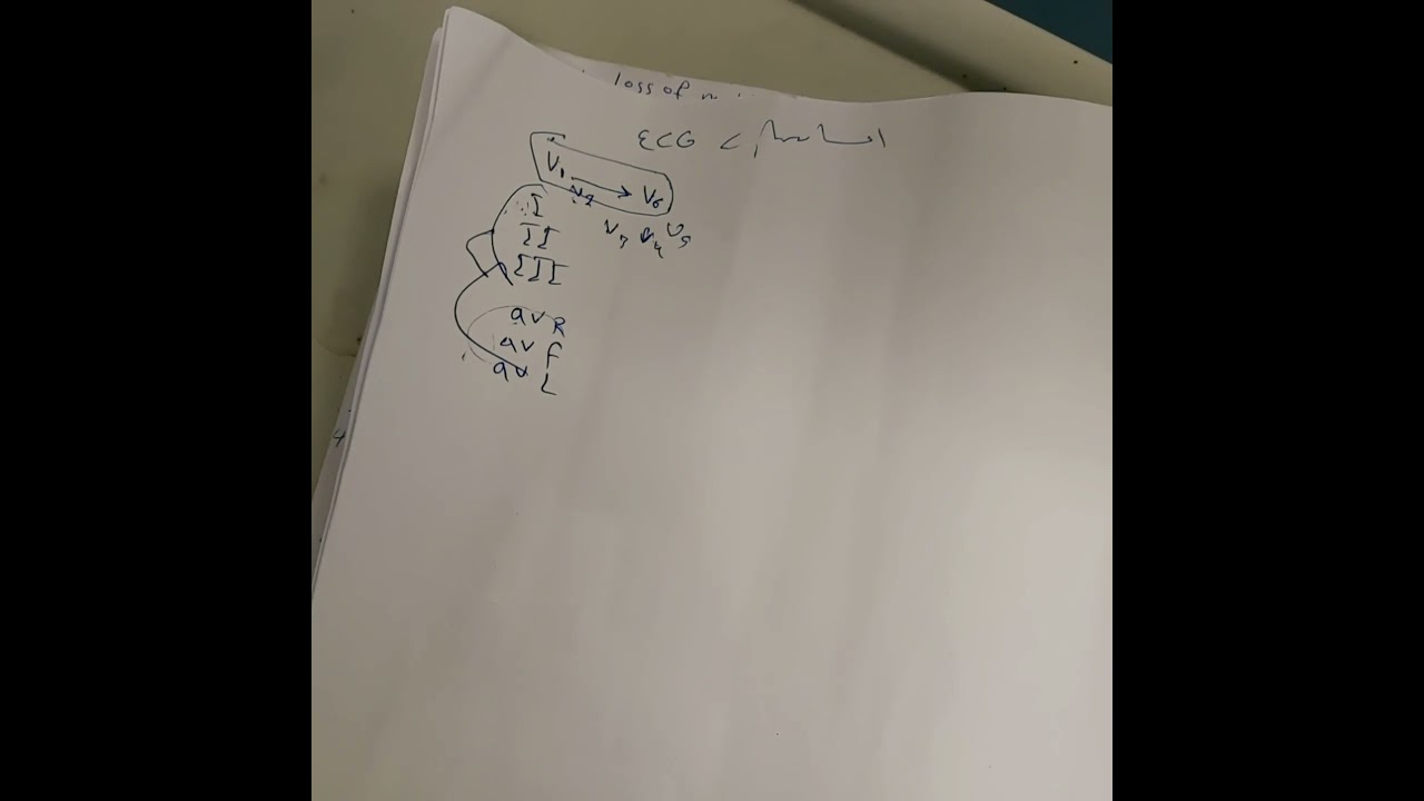 ECG part 2
