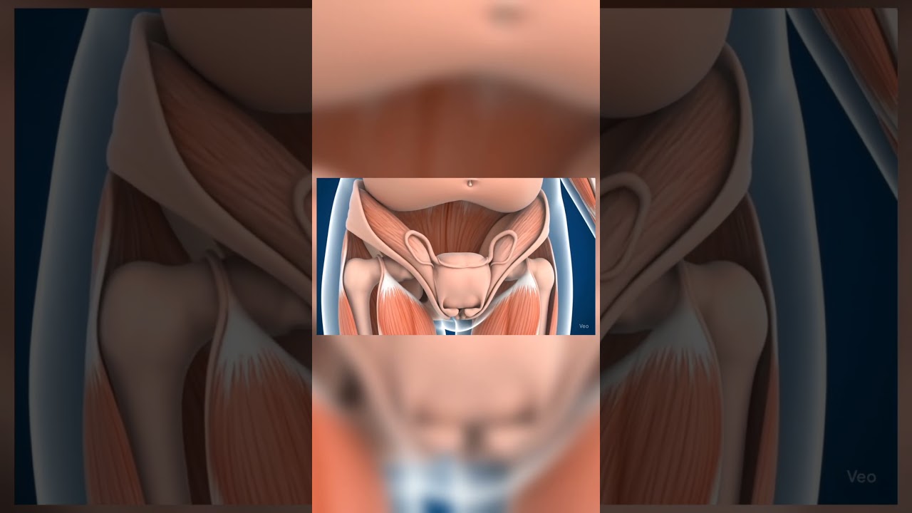 uterine prolapse problem in female #medical #animation #medicalanimation #health