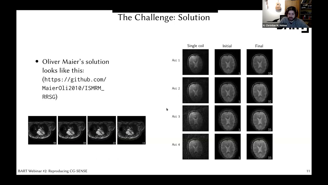 BART Webinar #2 - Tutorial 1 - SENSE reproducibility challenge