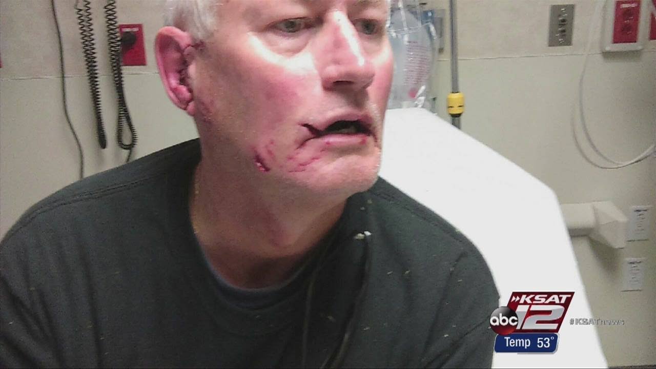 Man attacked by neighbor's pit bull near downtown