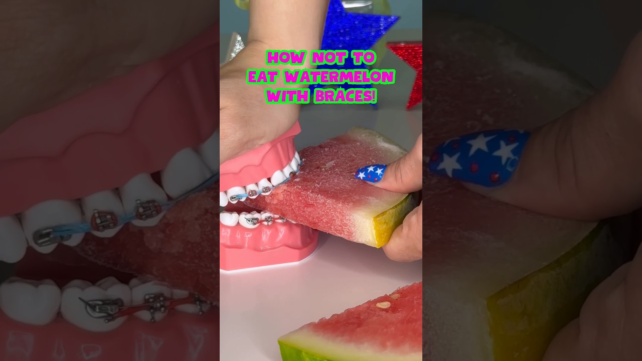 3 ways NOT to eat WATERMELON with BRACES *what to eat instead #braces #watermelon #summer