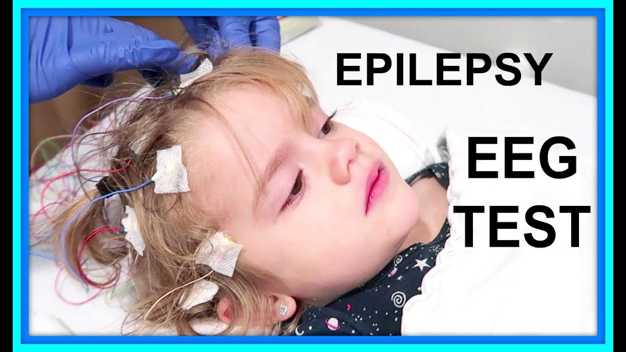 EEG TEST | EPILEPSY