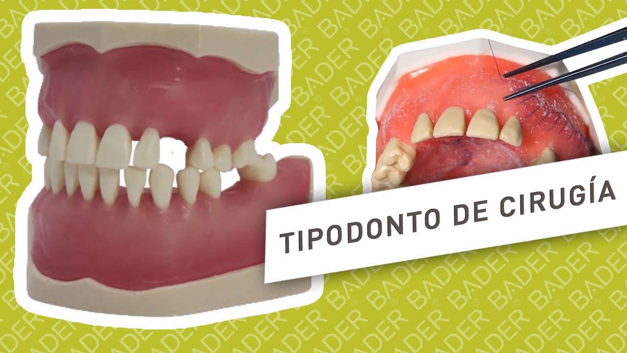 Tipodonto de cirug&iacute;a Bader&reg;