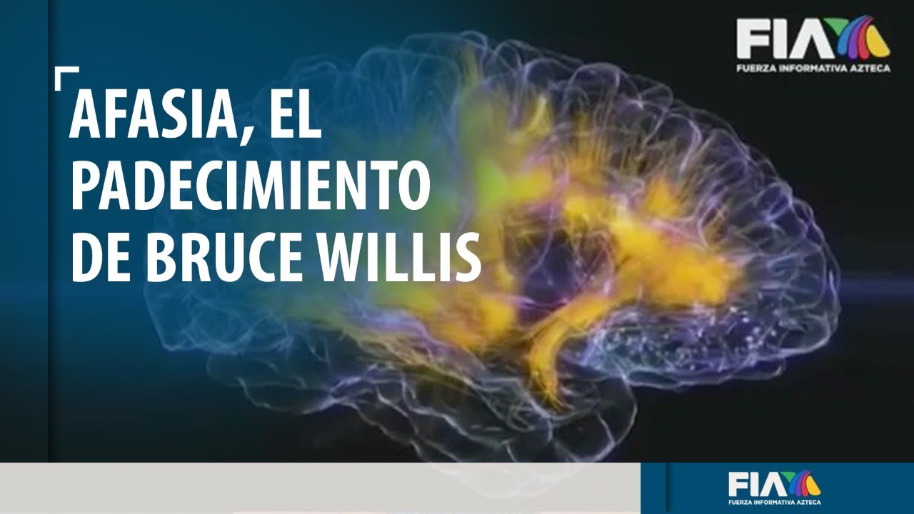 Afasia, el padecimiento por el que Bruce Willis se retira de la actuación